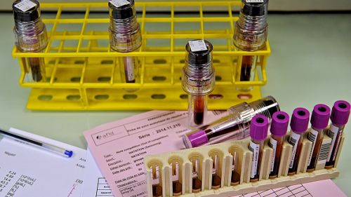 La procura di Bolzano prossima alle decisioni su Gottlieb e Daniel Taschler per i rapporti con Michele Ferrari?