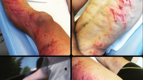 Simon Fourcade investito da un'auto e minacciato con un'ascia dal guidatore